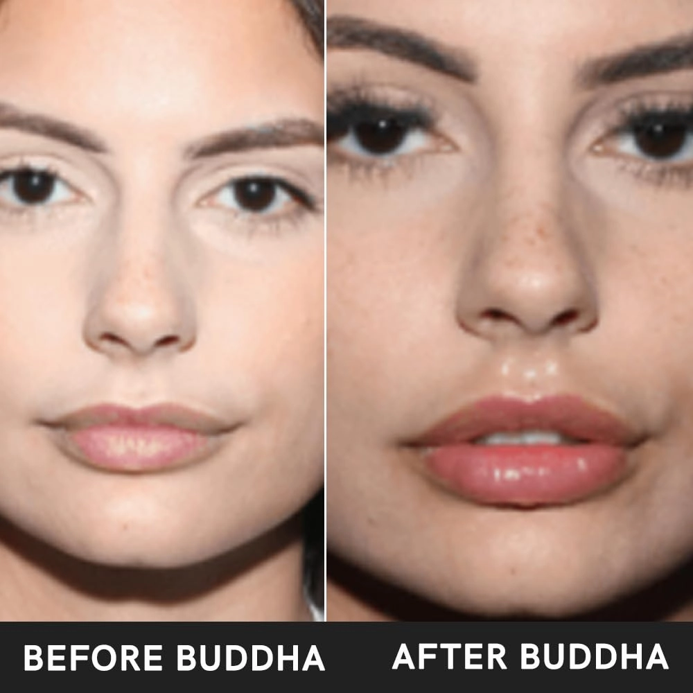 Berry Kiss Lip Balm With Rasberry (7 Gram) - 100% Ayurvedic, Vegan & Ayush - For Moisturized, Supple and Hydrated Lips